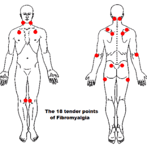 Fibromyalgia chronic fatigue and massage 2 CE
